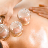 Cupping Therapy